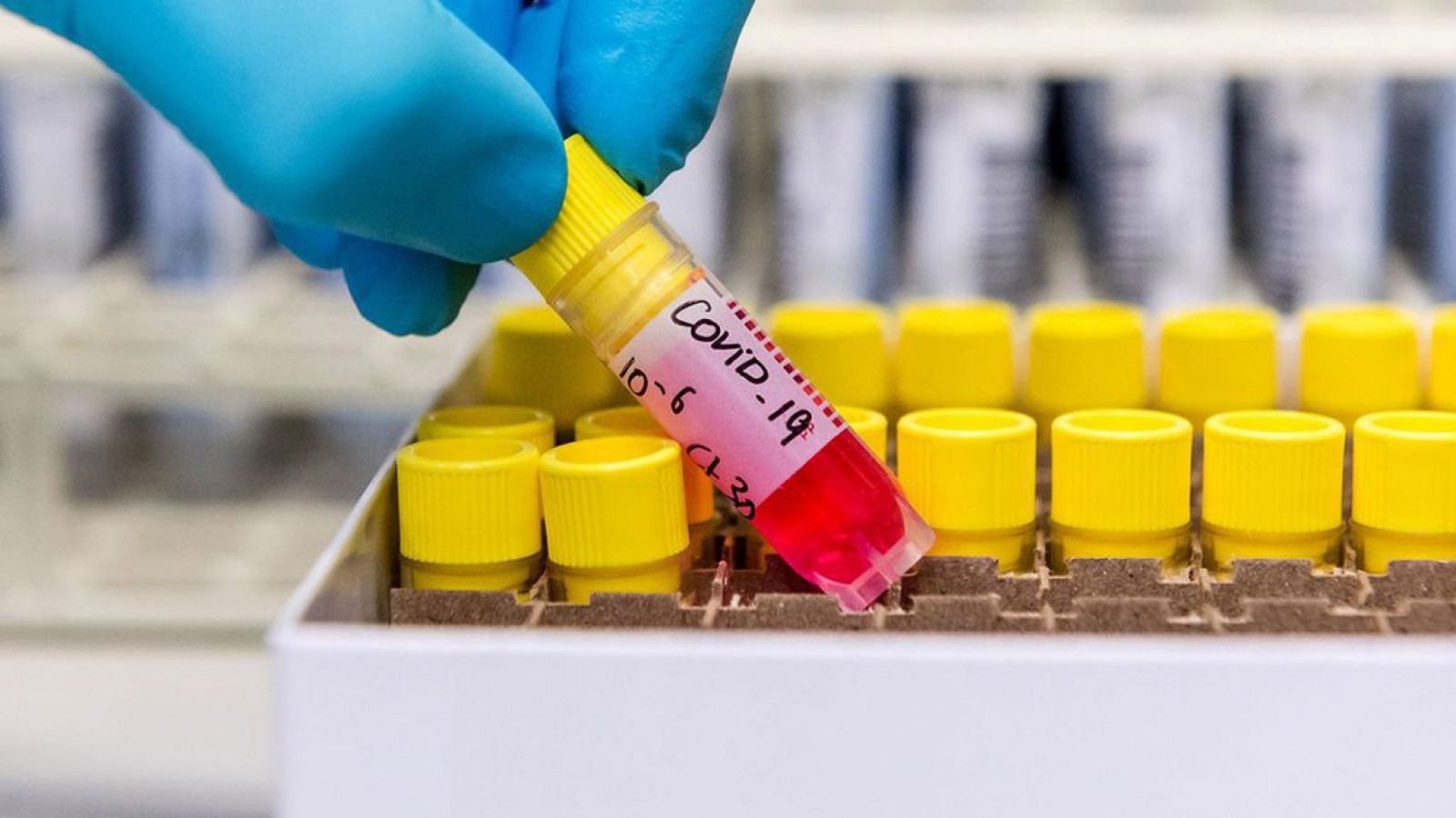 Argentina: Buscarán "predecir" la evolución del coronavirus en personas que se recuperaron
