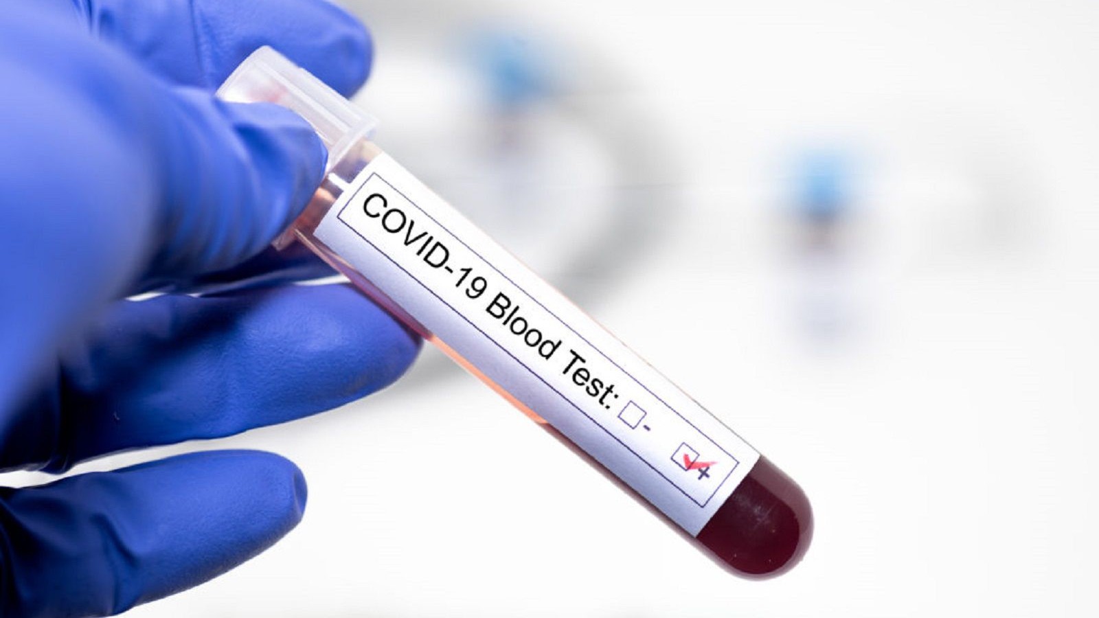 Argentina casi alcanza los 60 mil contagios desde el inicio de la pandemia