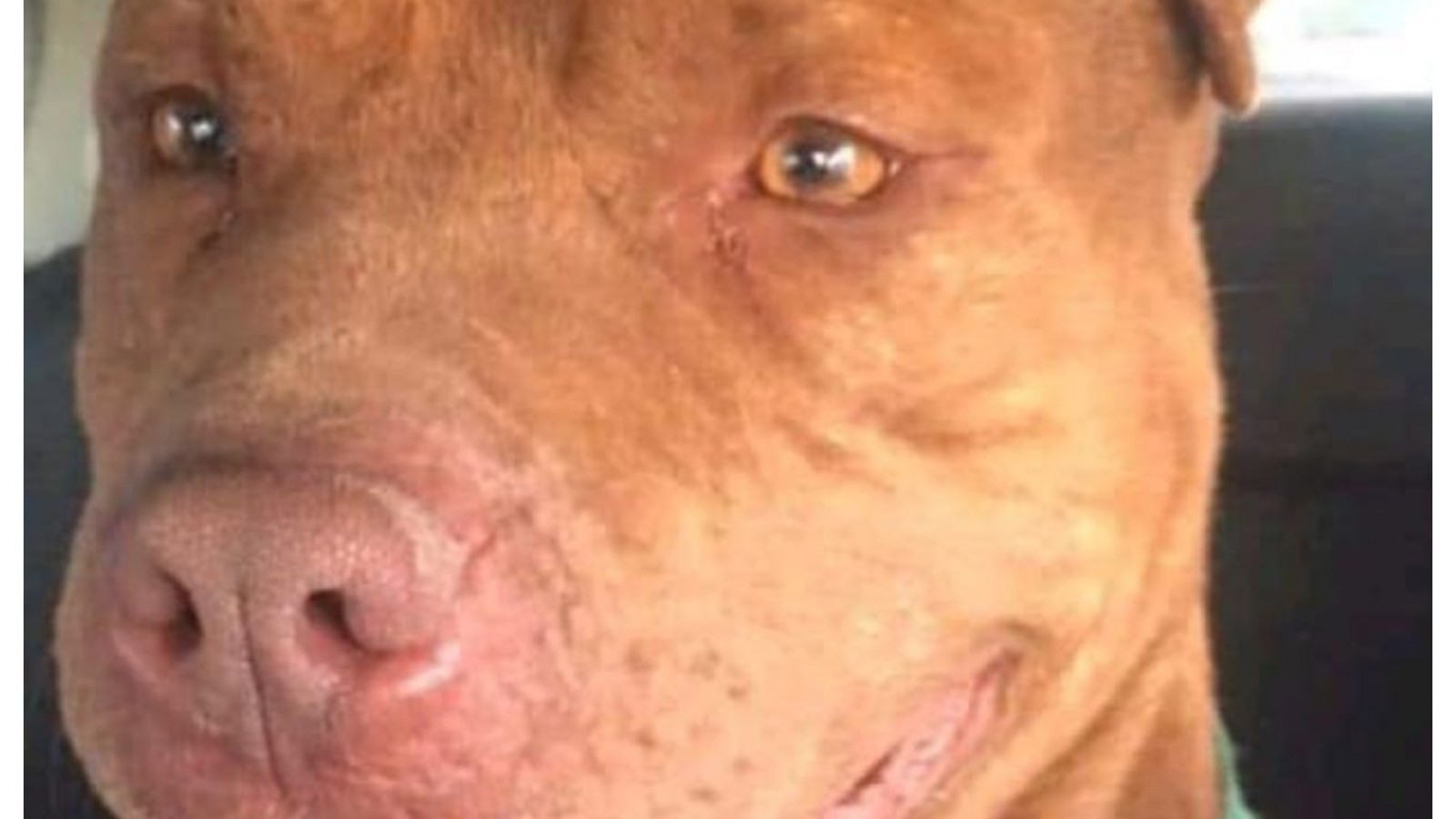 Fue operado éxitosamente el nene de 5 años atacado por un pitbull