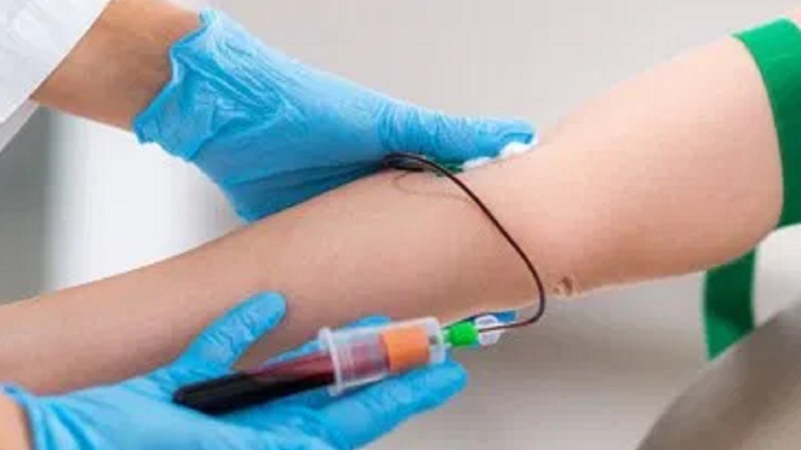 Donación de plasma :¿Ya está implementado el protocolo para la ciudad de Madryn?