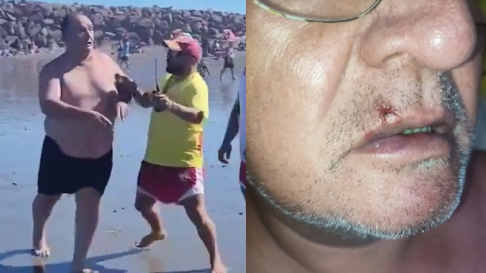 "Lugar al que voy me discriminan": El relato del turista agredido en Playa Unión