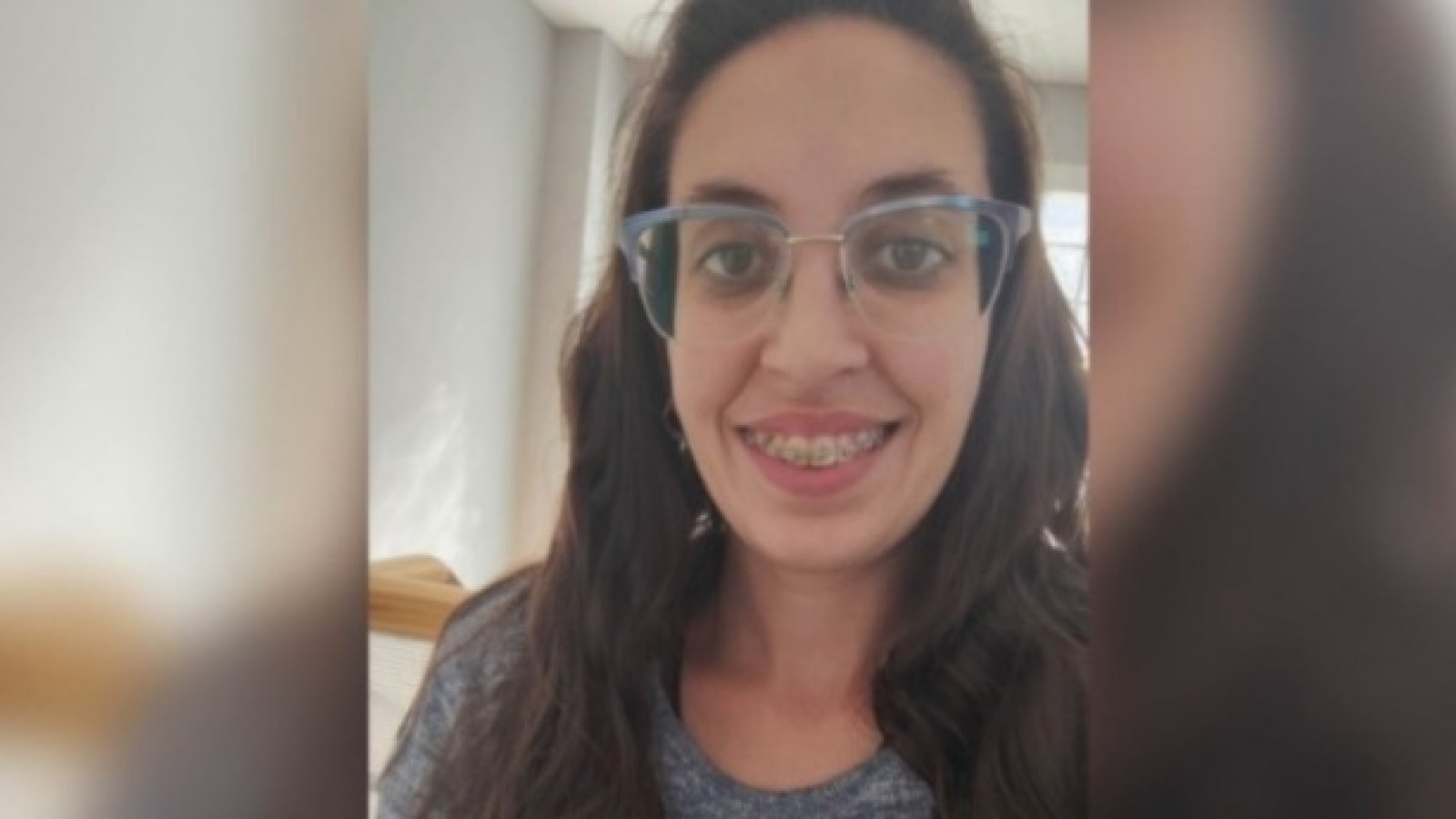Su obra social no cubre su cirugía de $14 millones y lanzó una colecta