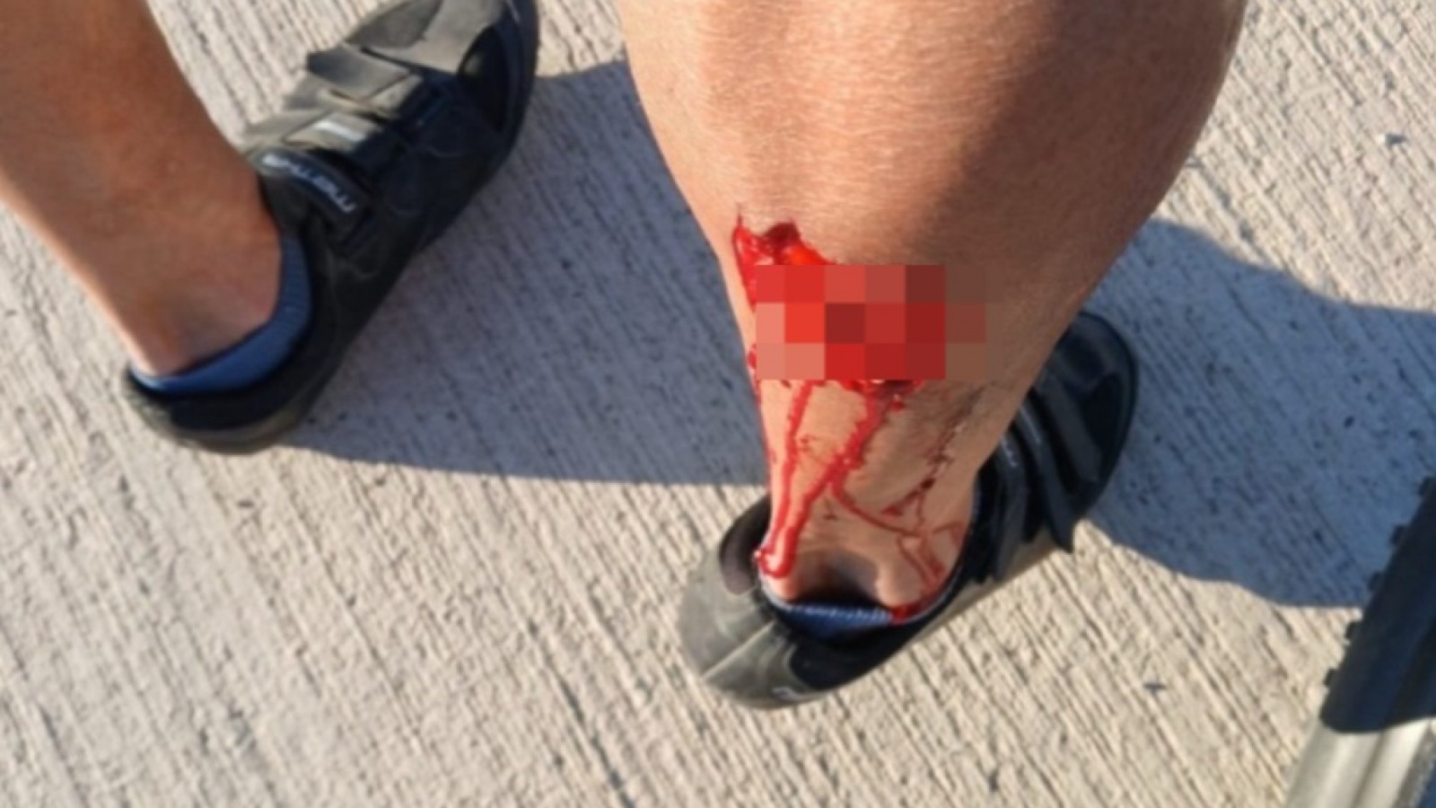 Indignación en Madryn: un perro mordió a un atleta y la dueña se fue sin hacerse cargo