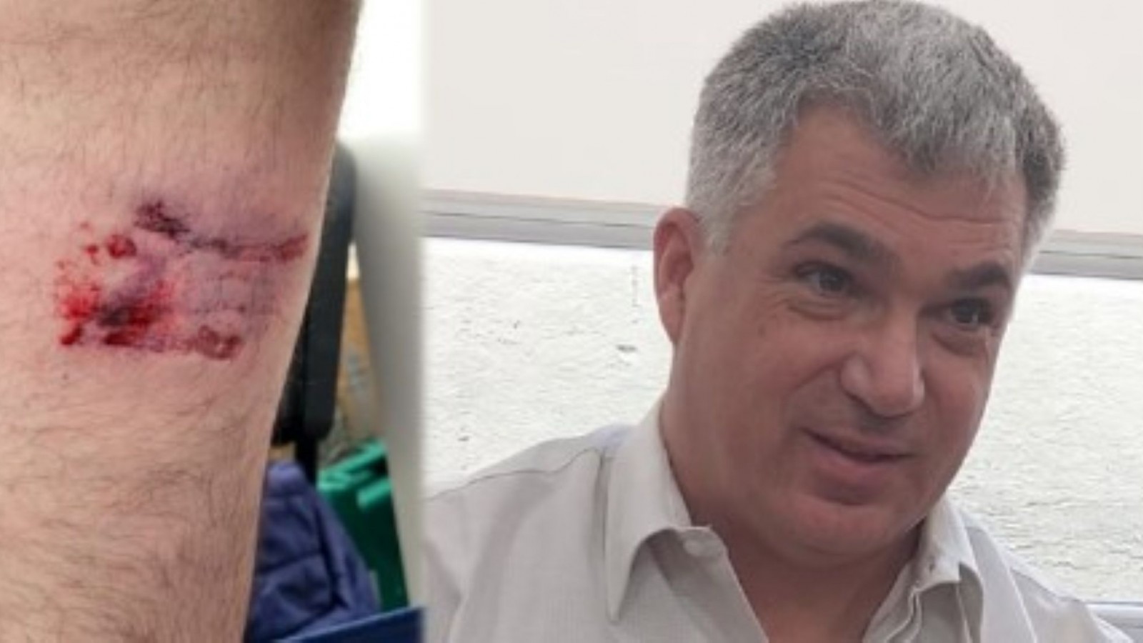 Un trabajador fue mordido por dos perros mientras tomaba el estado de los medidores