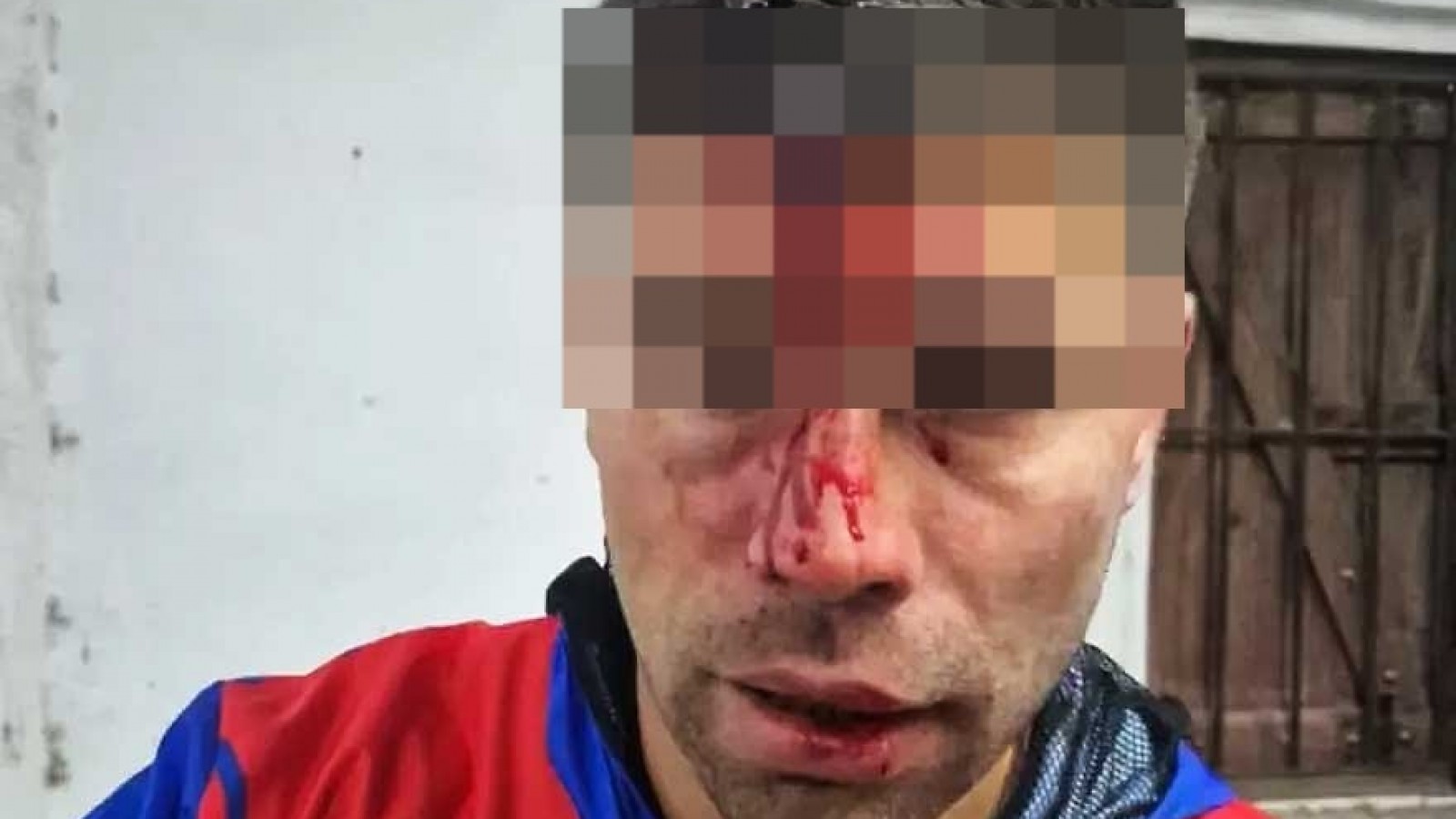 Le clavaron una llave en la cabeza a un futbolista durante una pelea en Berazategui