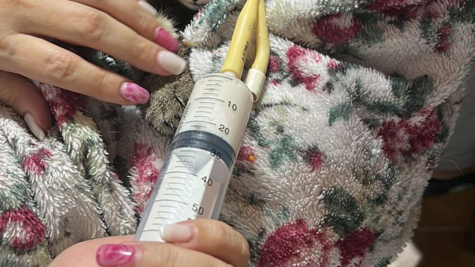 Piden ayuda para Loli: necesita alimentación por sonda y afrontan altos costos para su recuperación