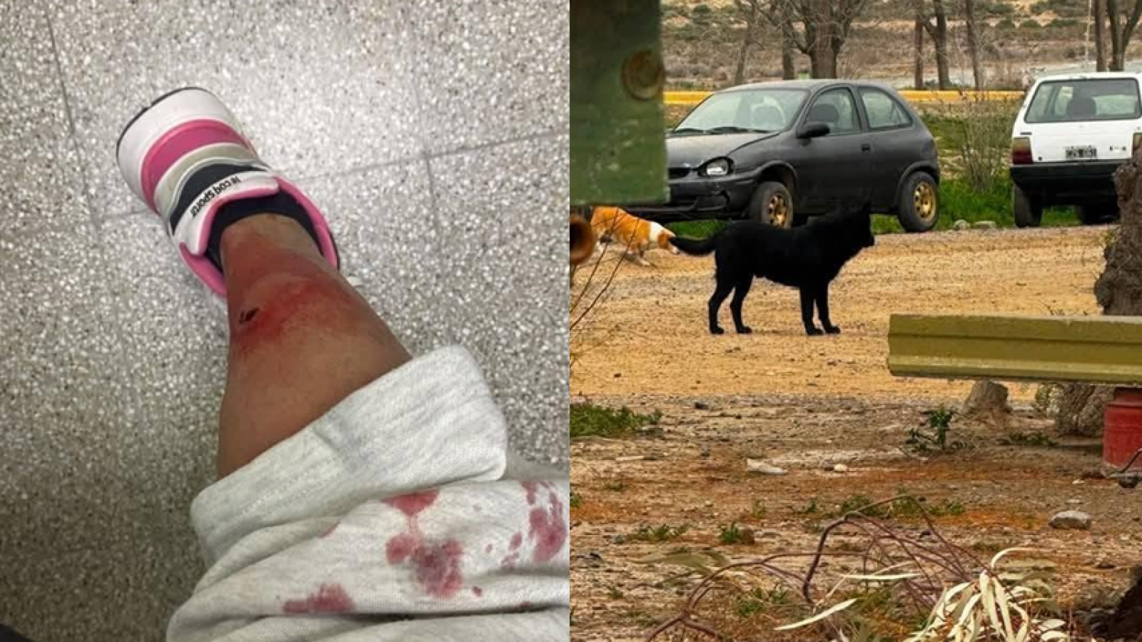 Puerto Madryn: una mujer denunció que fue atacada por dos perros y alertó por el peligro para los vecinos