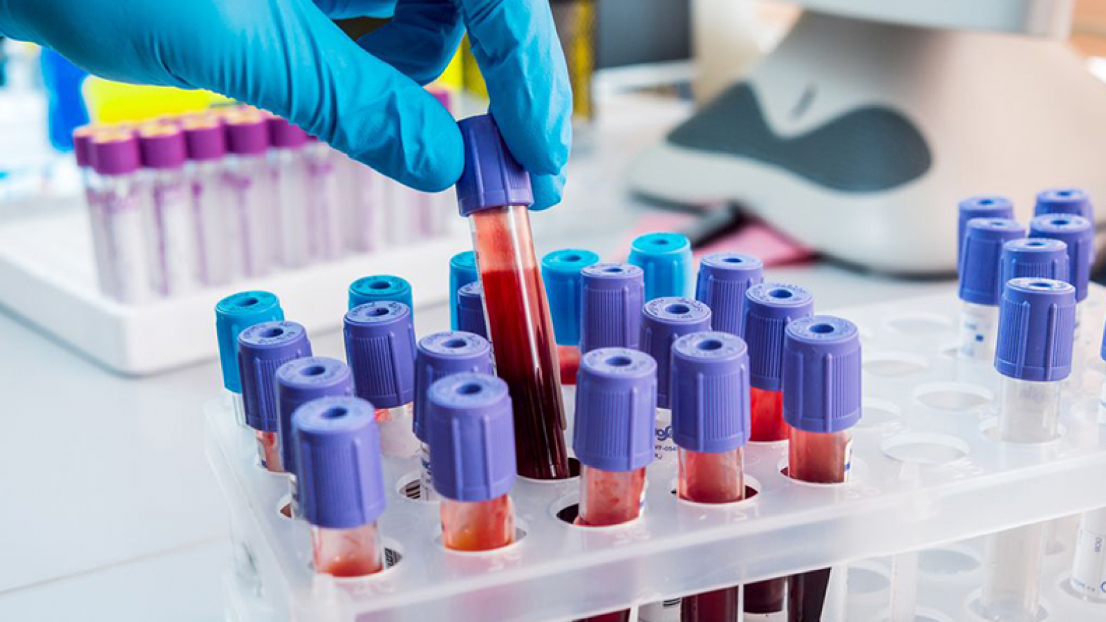 Bioquímicos de Chubut amenazan con cortar las prestaciones a afiliados de Seros